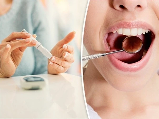 🦷 «Как сахарный диабет влияет на здоровье зубов: 3 главных риска»

Сахарный диабет влияет не только
