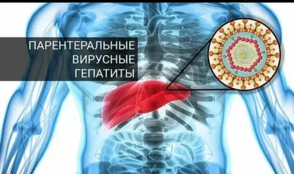 ✅Защити себя и своих близких от парентеральных вирусных гепатитов 

⚠Вирусные гепатиты — это группа 