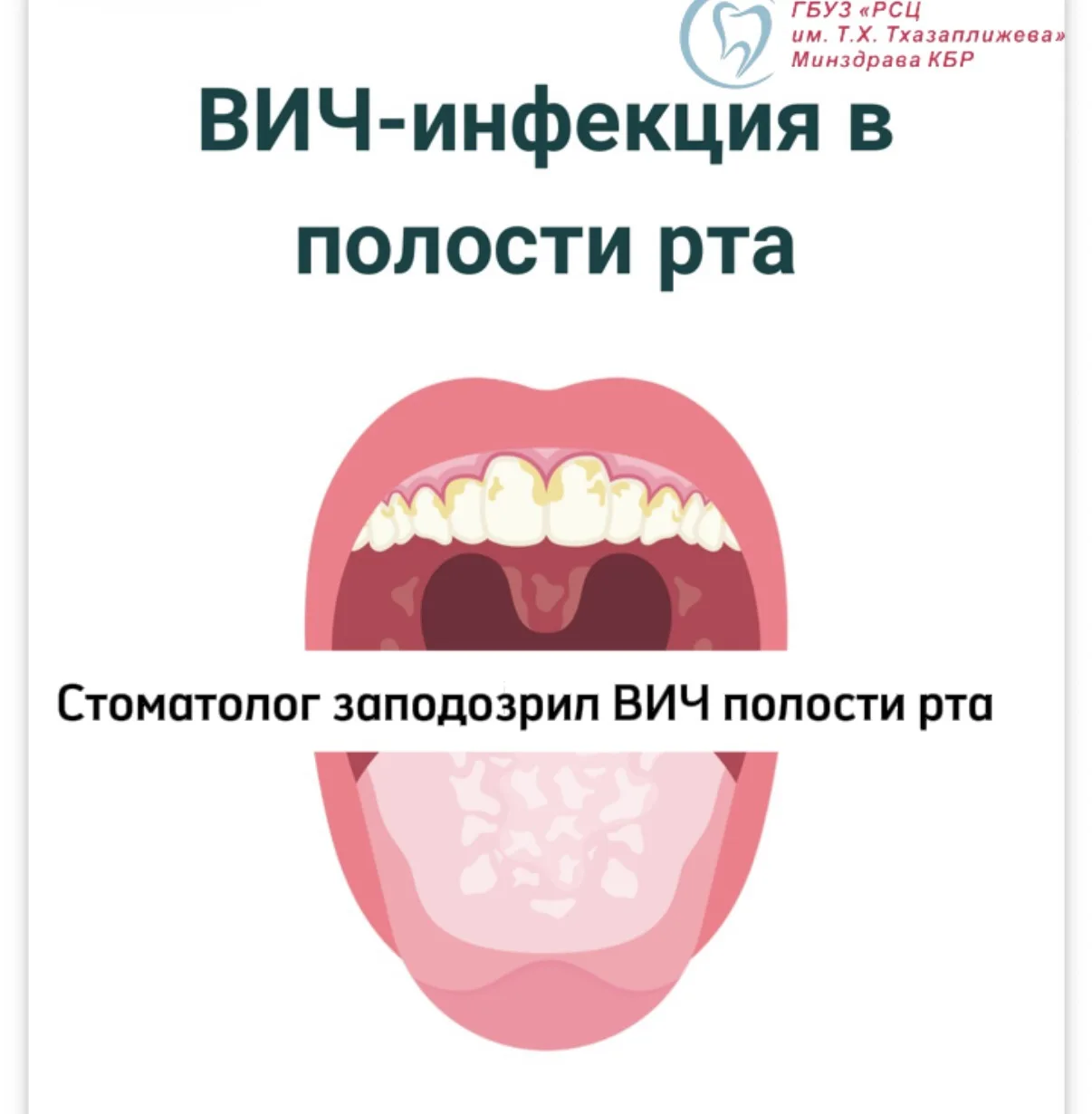 что делать дальше?

👨🏻‍⚕️Срочно обратитесь к врачу-инфекционисту

💊💉Начните антиретровирусную те