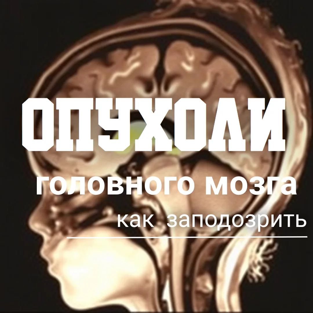 Тревожные звоночки: как заподозрить опухоль головного мозга у ребенка?
