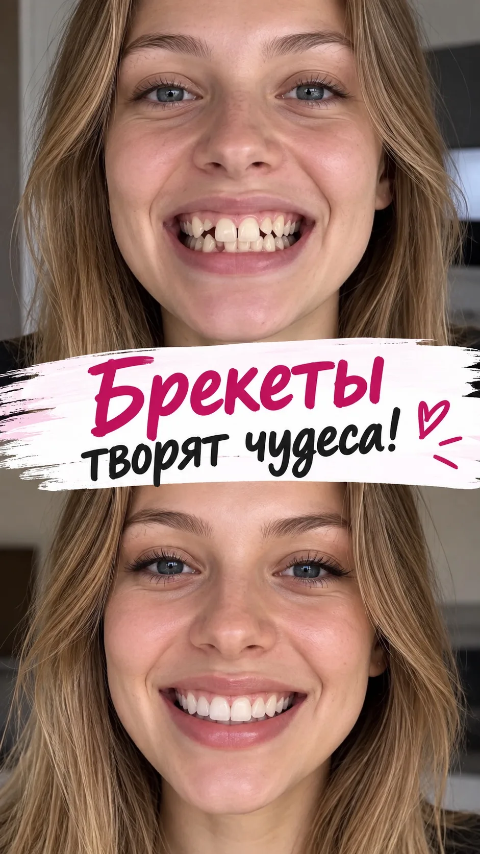 Брекеты способны изменить вашу внешность и они настолько эффективны, что их не может ос...