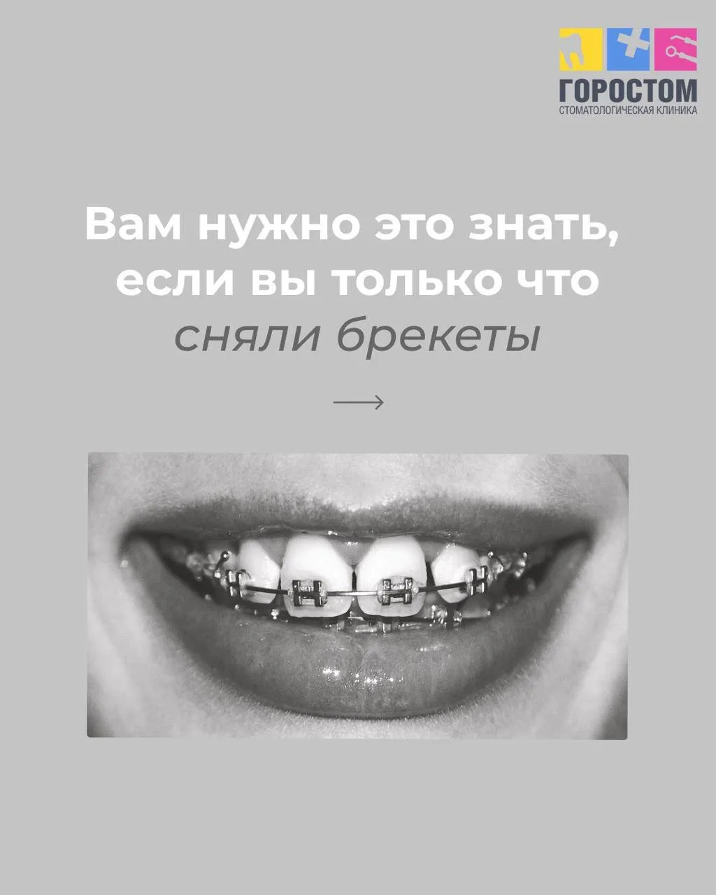 Брекеты сняли? Это ещё не всё 😌
