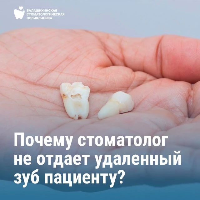 Почему стоматолог не отдаёт удалённый зуб пациенту? 🦷❓