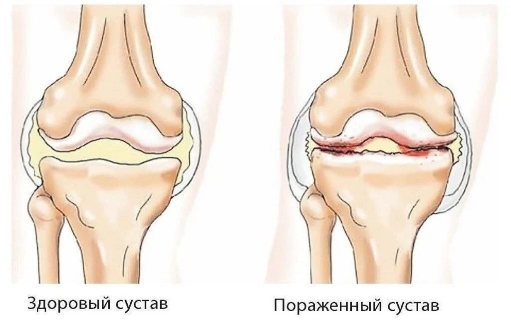 🌿 Советы для здоровья суставов!