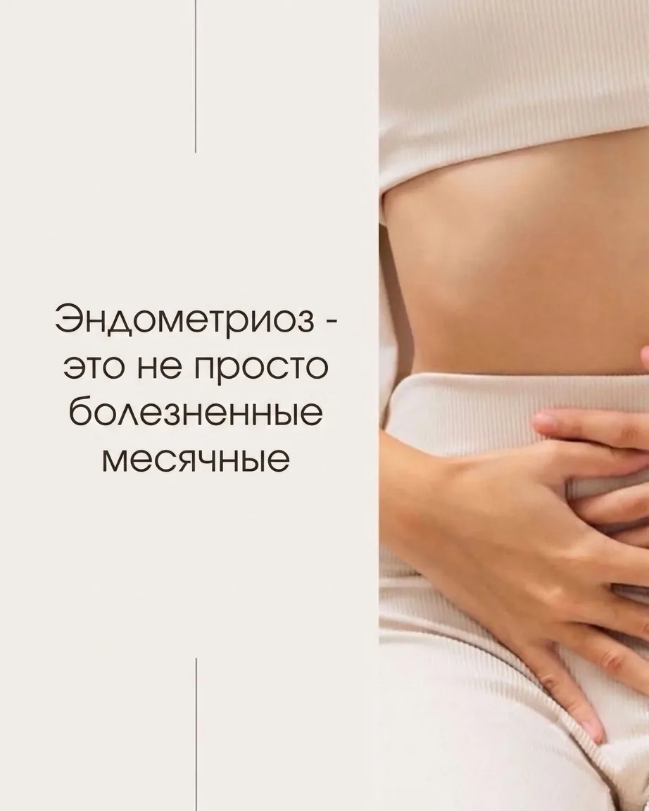 «Это просто болезненные месячные» - фраза, из-за которой тысячи женщин годами живут с э...