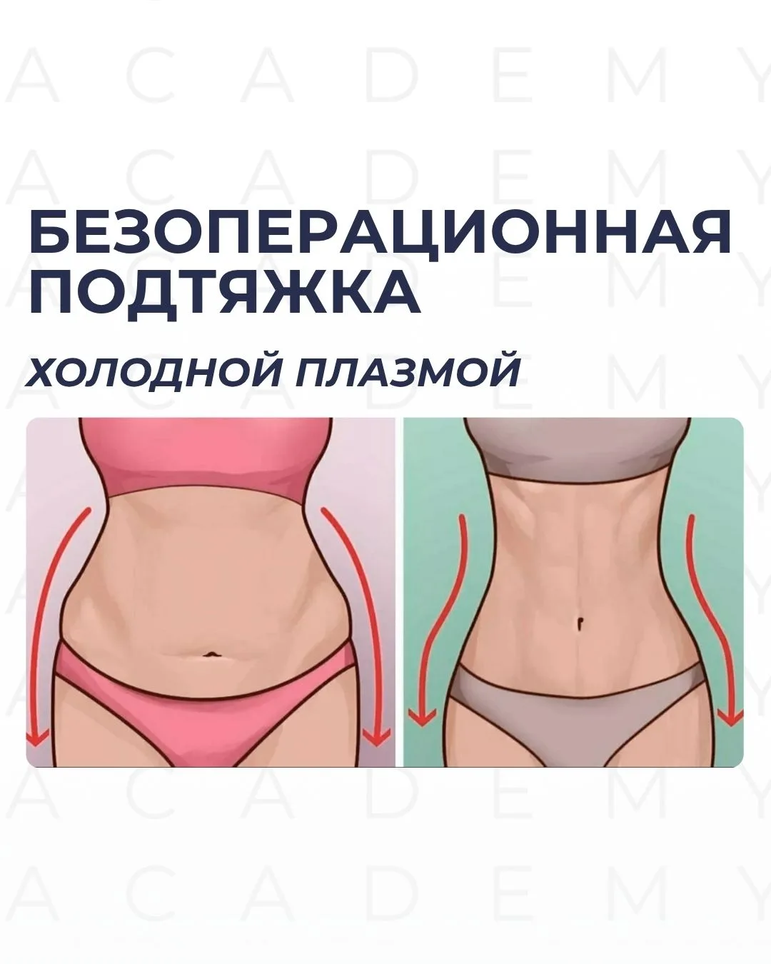 БЕЗОПЕРАЦИОННАЯ ПОДТЯЖКА КОЖИ ХОЛОДНОЙ ПЛАЗМОЙ 😍

Всем нам девочкам хочется выглядеть потрясающе. Н
