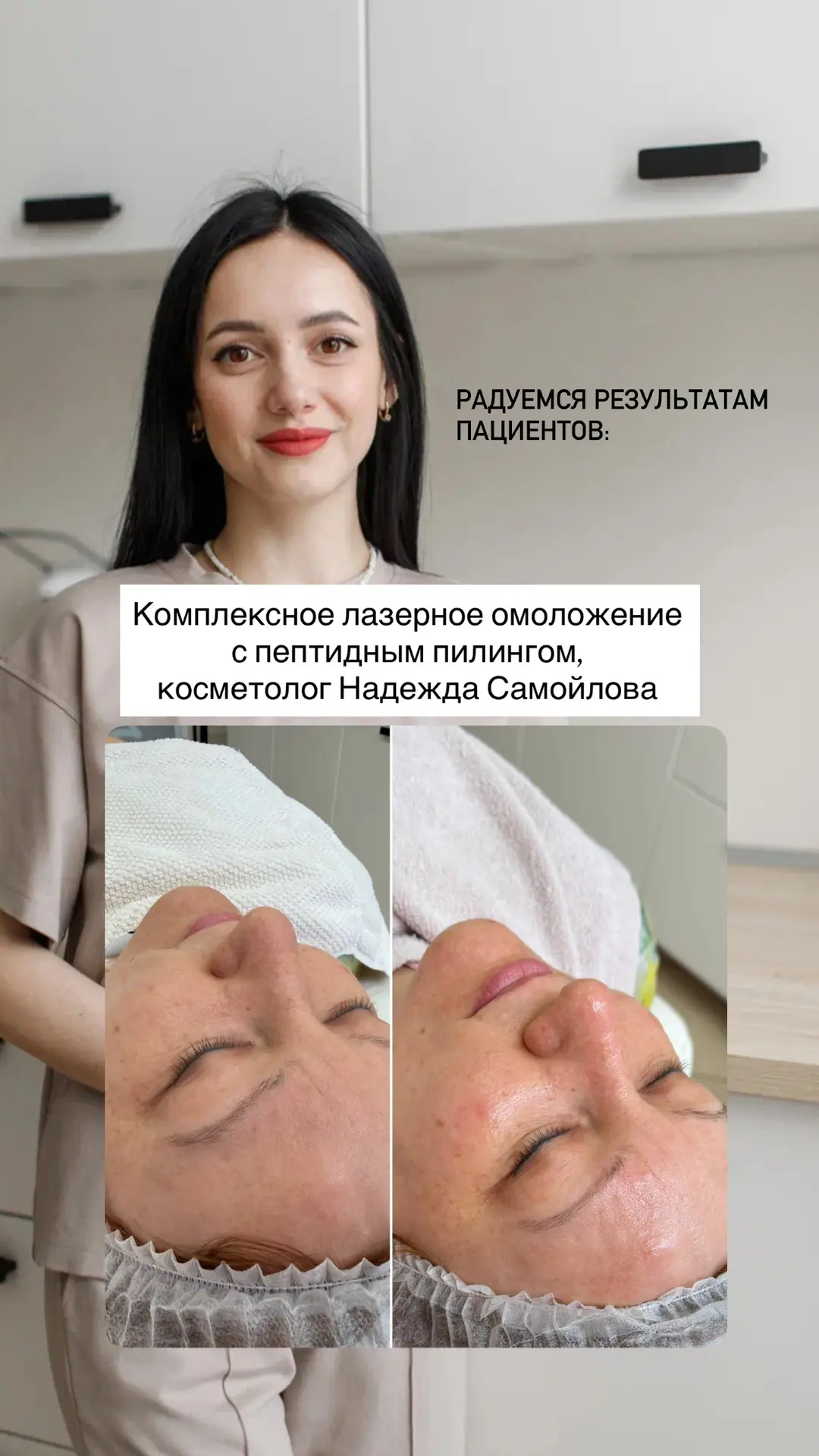 Чтобы сделать кожу сияющей, напитанной и увлажненной, записывайтесь на уходовые процеду...