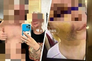 Женщина, с которой бывший отсудил 100 тысяч рублей за сталкинг, заявила, что он её изби...