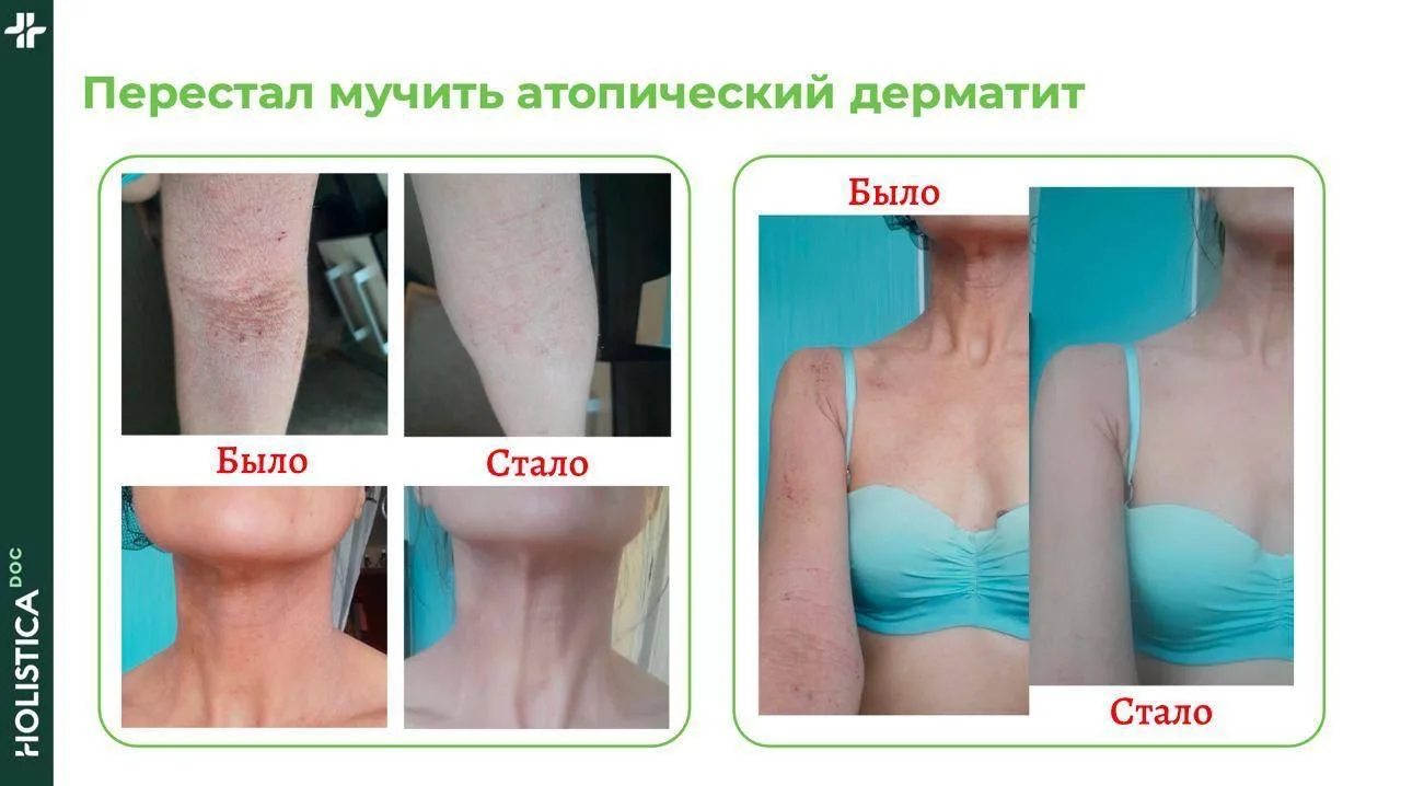 Как убрать воспаление в ЖКТ и не сделать себе хуже   Если вы годами живете со вздутием, тяжестью, пр