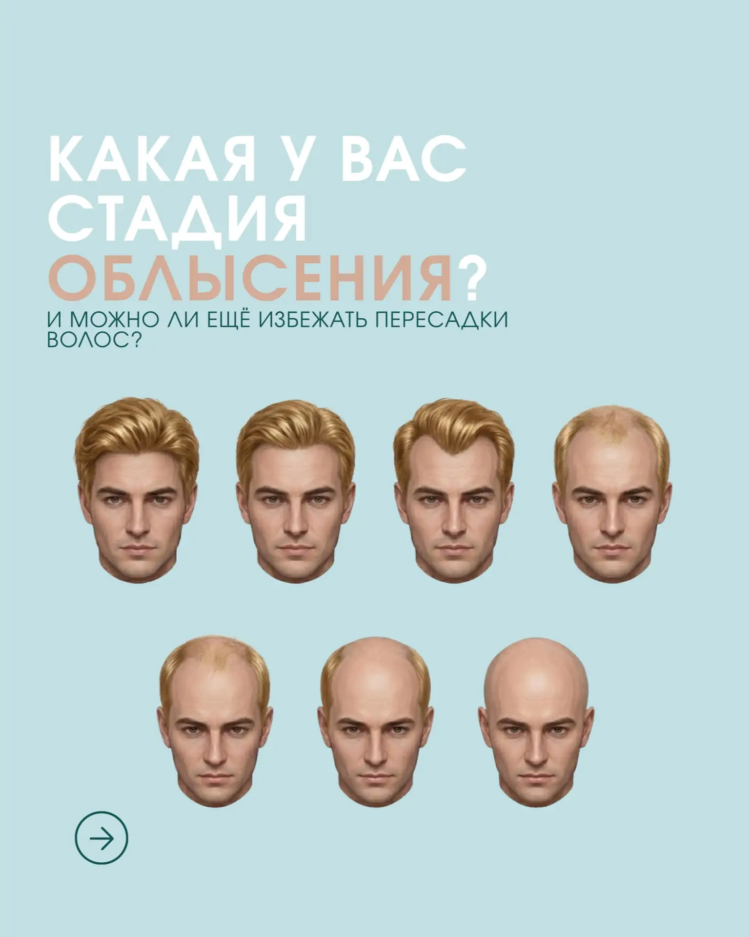 Каждая стадия облысения — это не приговор, а момент, когда важно выбрать правильную тактику.
Чем ран