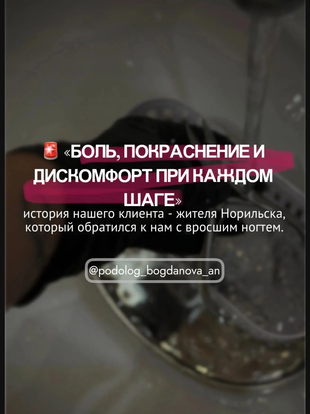 К нам обратился клиент с жалобами на боль, покраснение и дискомфорт из-за вросшего ногт...