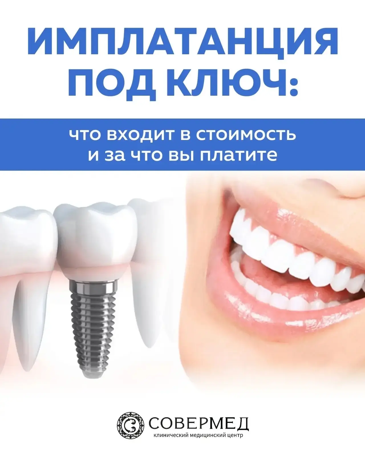 Имплантация «под ключ» — это уверенность в результате,
а не просто одна процедура 🦷

Многие ориенти
