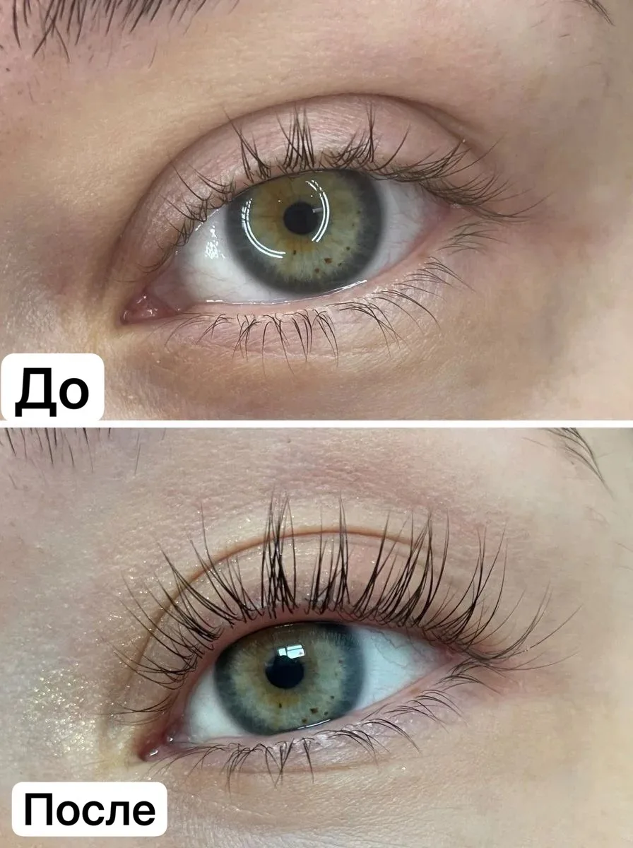 «Девочки, я в шоке от результата 😍