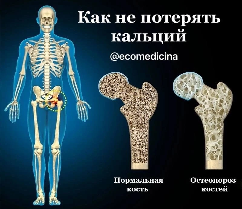 🍕КАК НЕ ПОТЕРЯТЬ КАЛЬЦИЙ

Вот 10 факторов, которые могут привести к вымыванию кальция из костей, чт