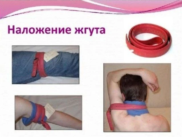 Друзья, мы всегда отводим много времени на курсах для  правил наложения жгута. Рассказы...