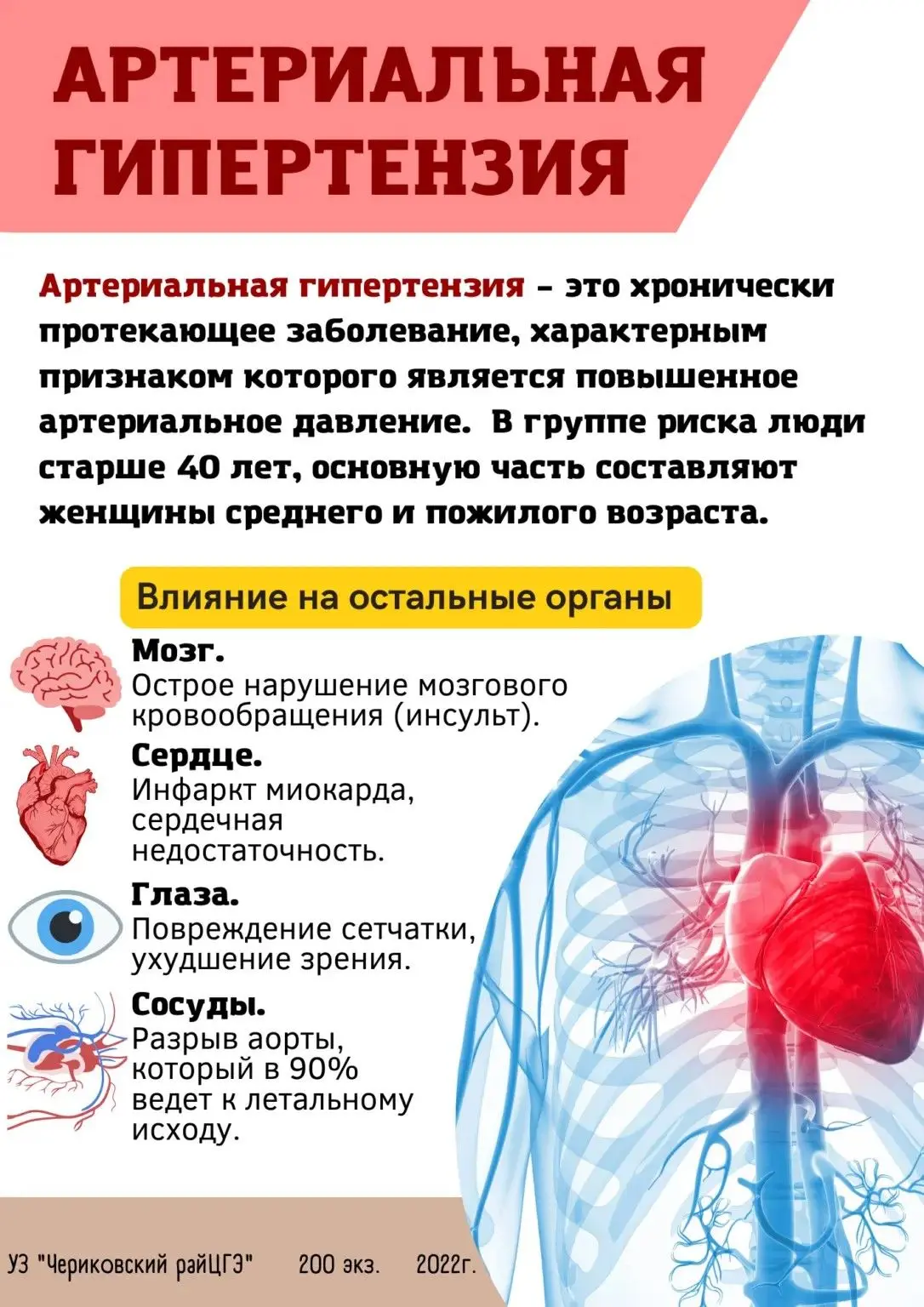 Гипертоническая болезнь - хроническое заболевание, проявлением которого служит стойкое ...