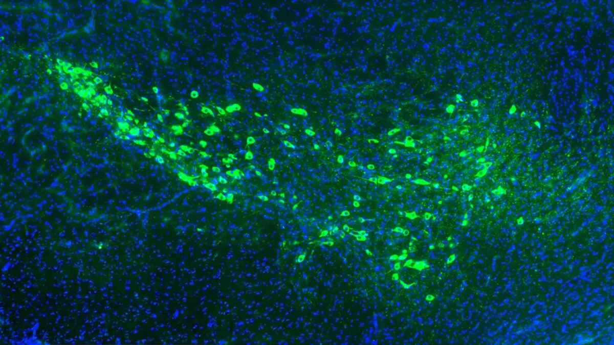 🔬 Два белка помогали патологическому α-синуклеину распространяться в мозге мышей