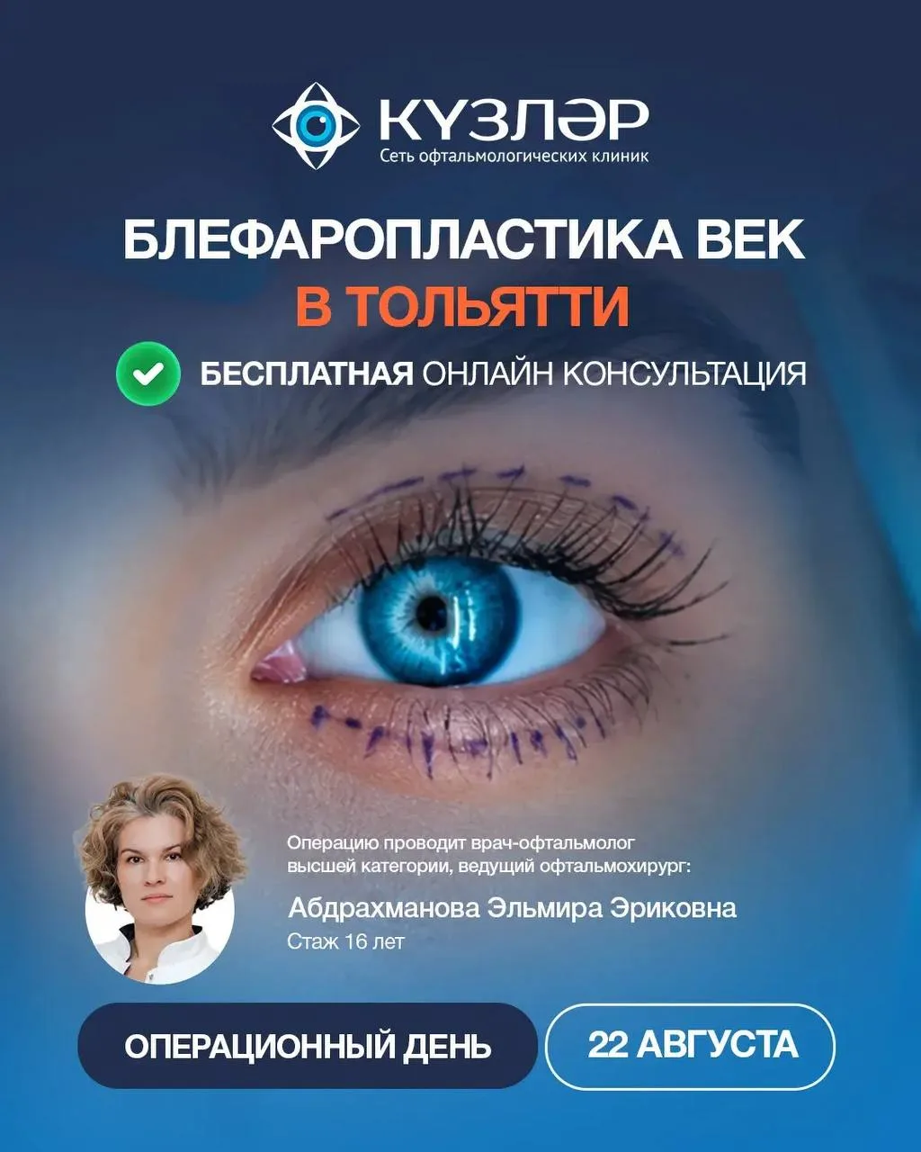 ✨ БЛЕФАРОПЛАСТИКА В📍ТОЛЬЯТТИ!