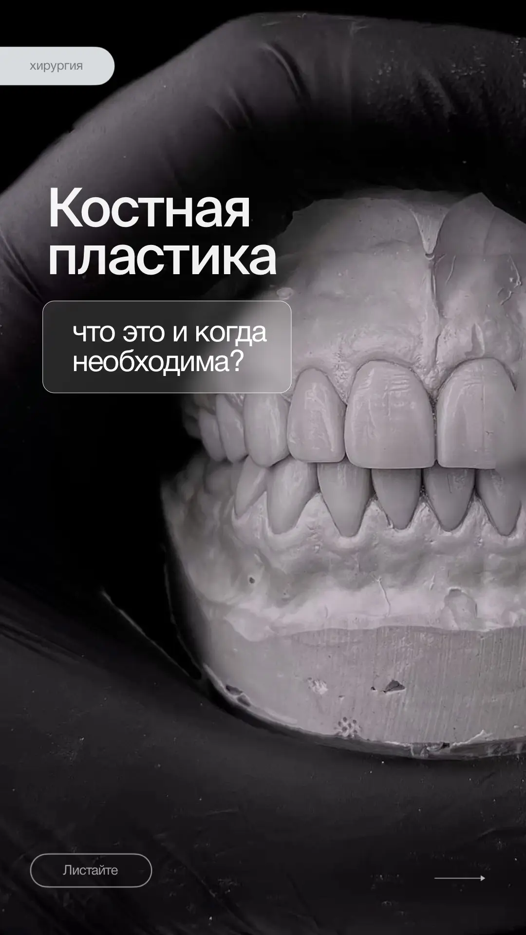 📌КОСТНАЯ ПЛАСТИКА