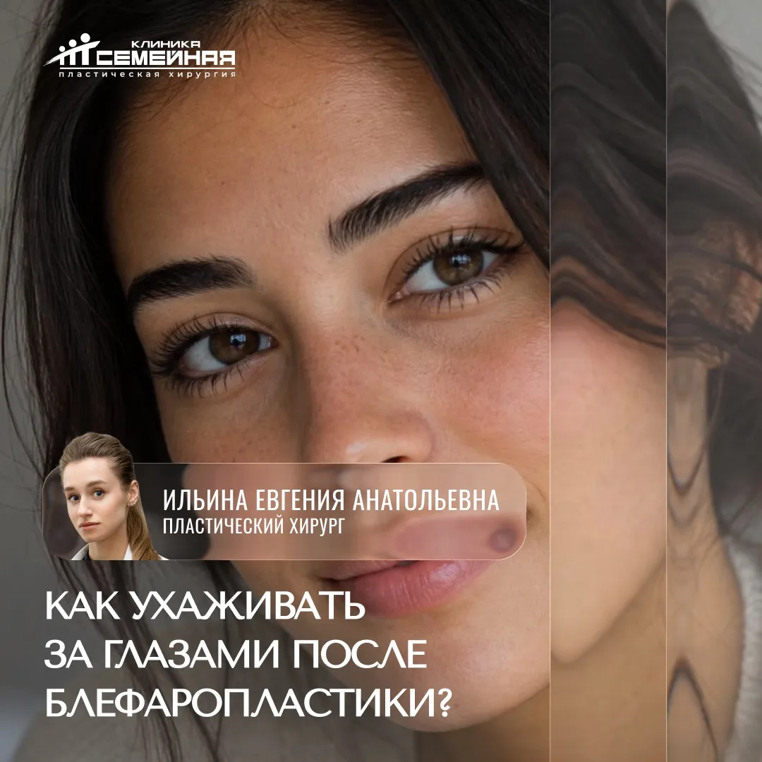 Как ухаживать за глазами после блефаропластики?

Простые правила, которые помогут закрепить достигну