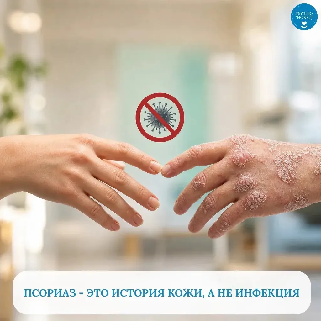 ПСОРИАЗ: РАЗВЕИВАЕМ МИФЫ О ЗАРАЗНОСТИ