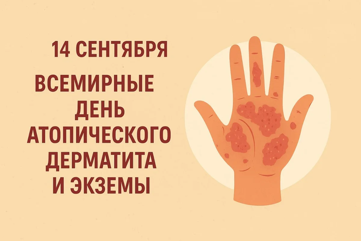 14 сентября — Всемирный день атопического дерматита и экземы 🧴🌿