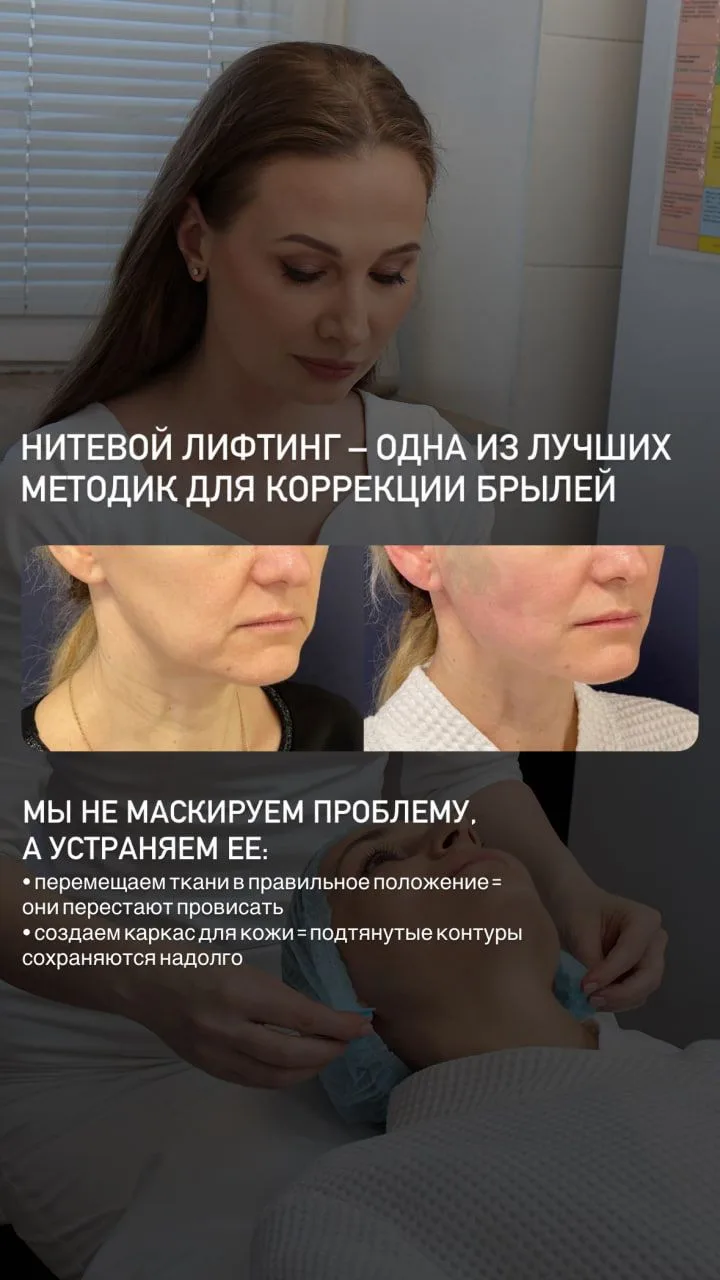 Филигранно убираем брыли любой сложности 💪