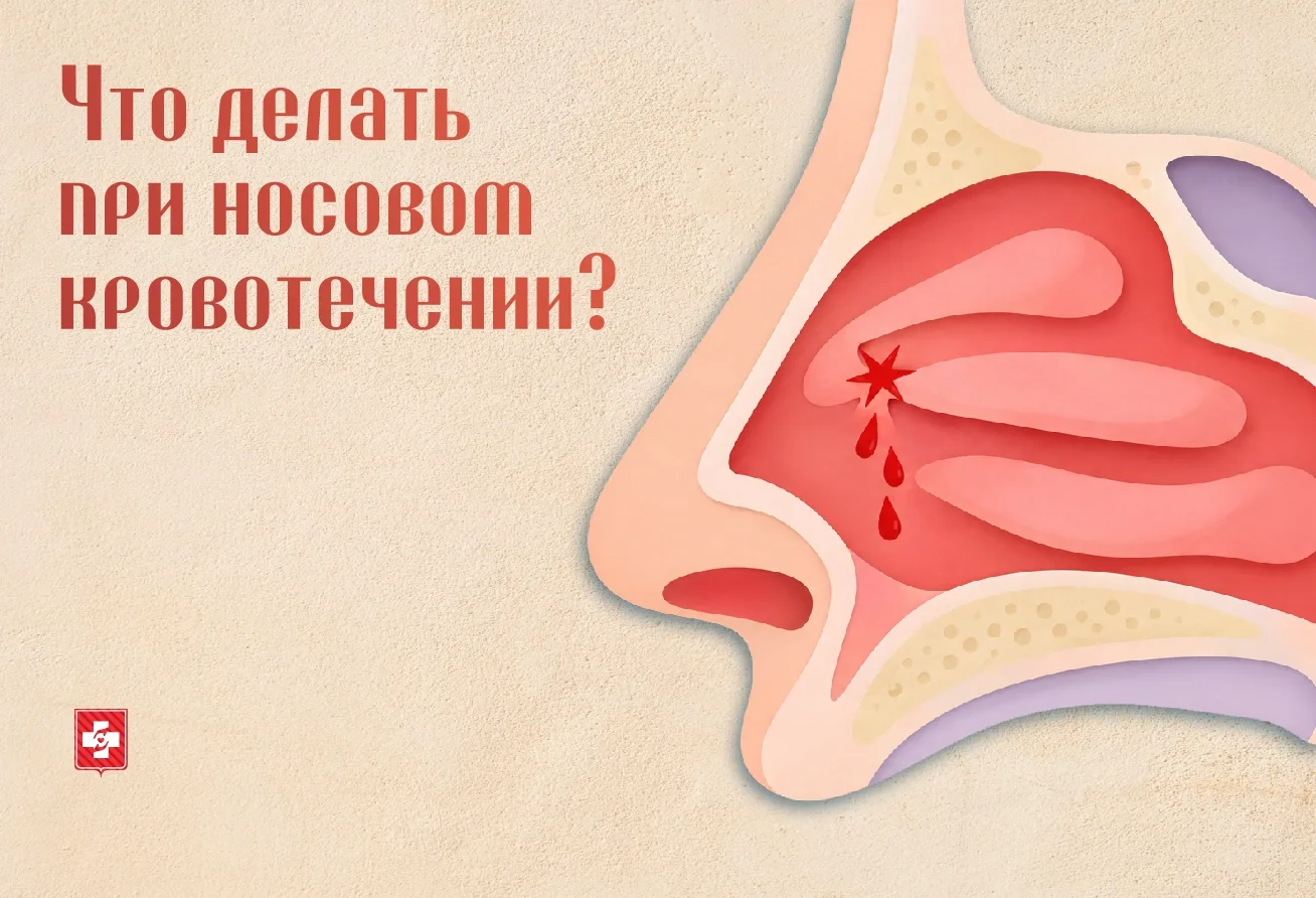 Носовое кровотечение у ребёнка: чего делать НЕ нужно? 🩸