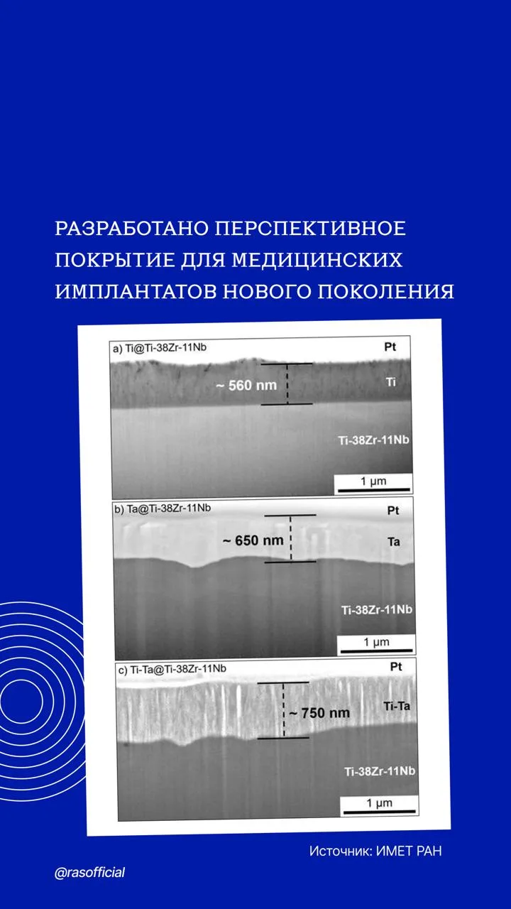 Учёные из Института металлургии и материаловедения им. А.А. Байкова РАН представили новое покрытие д
