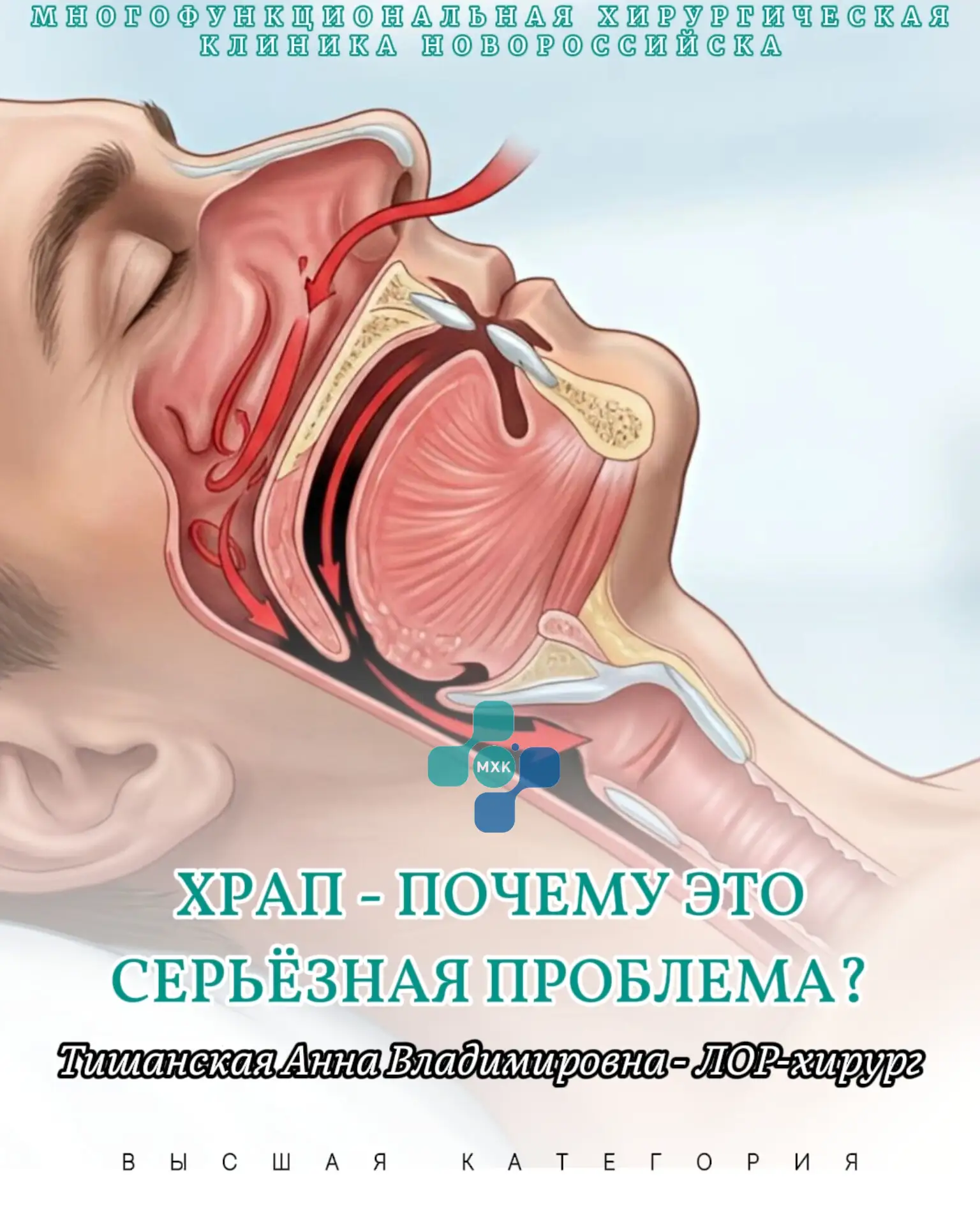 😴 Храп — это не просто звук, мешающий спать вашим близким. Это сигнал организма о серьезной проблем
