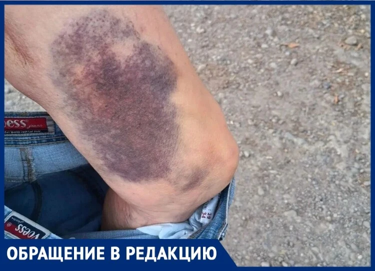 В Таганроге двухметровая яма у рынка «Берёзка» угрожает людям и животным ⚠️