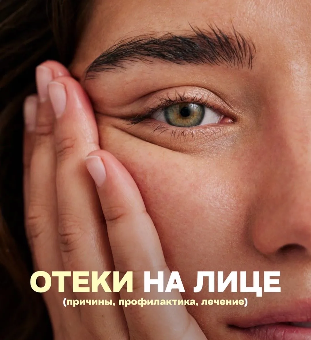Отёки на лице: причины, профилактика и коррекция 🩷

Если лицо по утрам выглядит «помятым» и одутлов