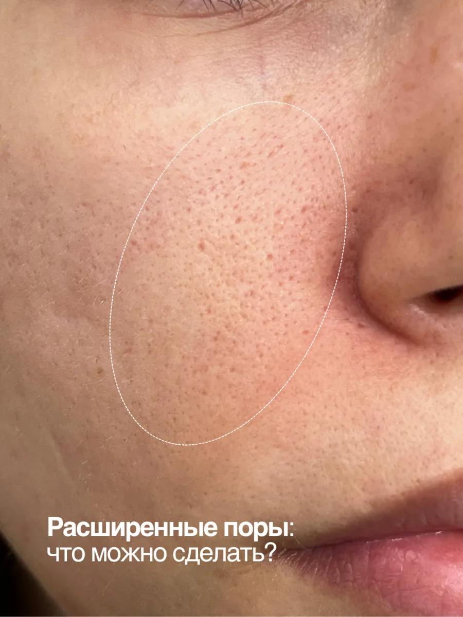 Листайте карусель 🥰