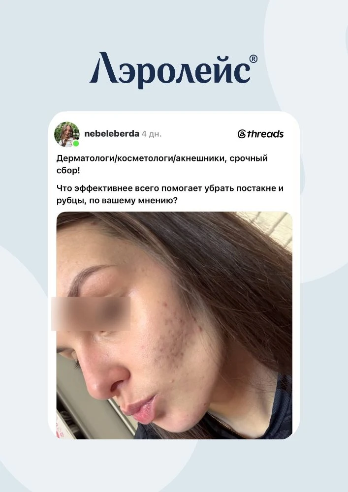 Как работать с рубцами постакне?

🔎 Большинство эффективных методов коррекции рубцов основаны на ко