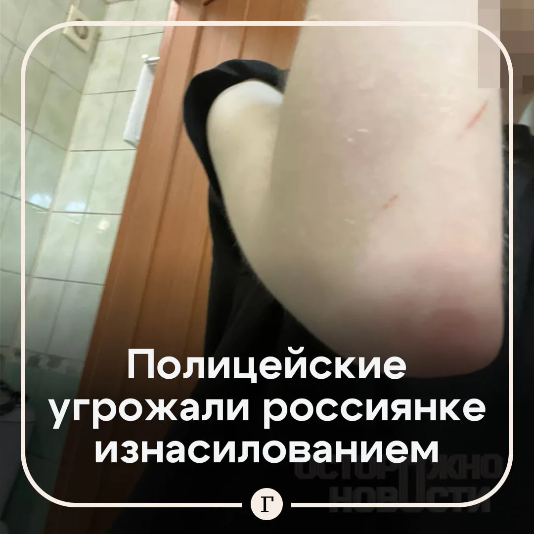 Россиянка обвинила полицейских в избиении.

На грубое обращение со стороны правоохранителей пожалова