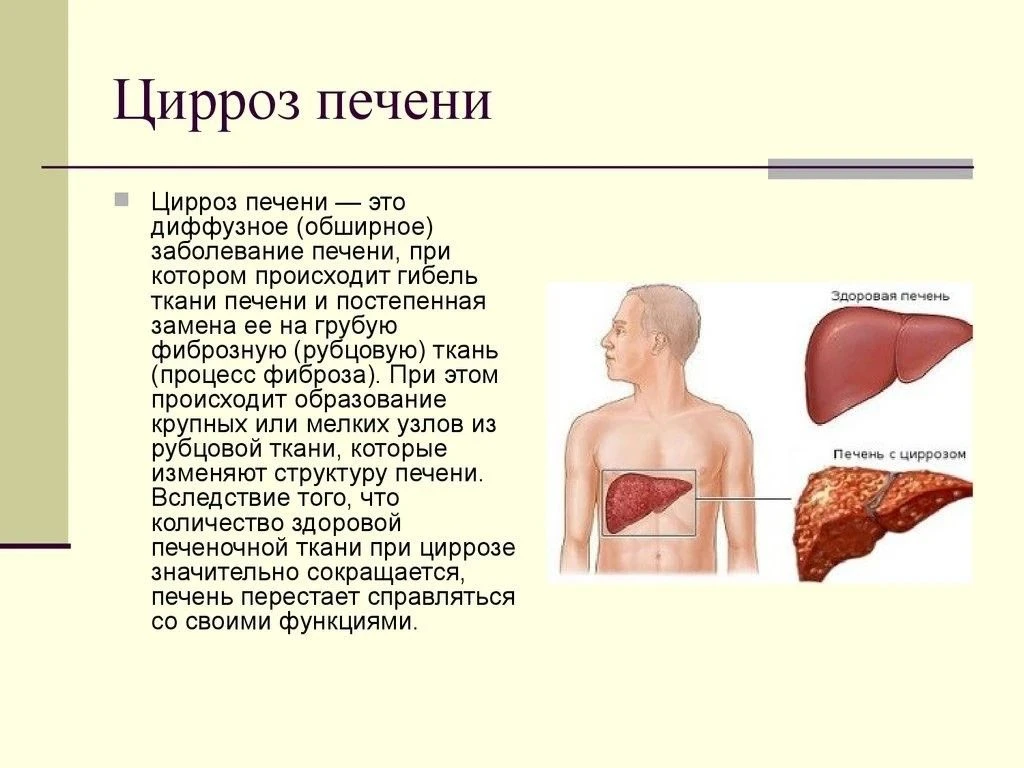 ✨Не занимайтесь само лечением! При возникновение симптомов обращайтесь к врачу ! ✨
