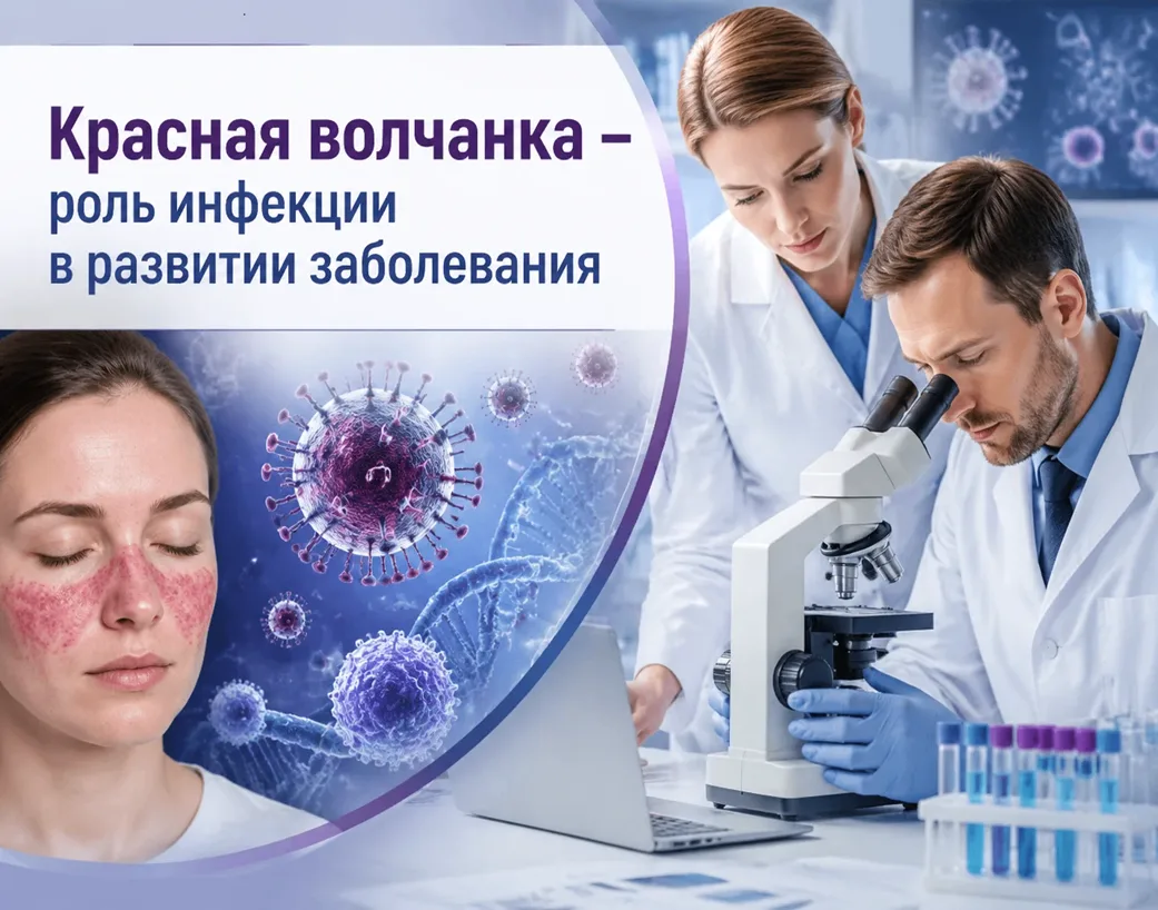 Красная волчанка – роль инфекции в развитии заболевания