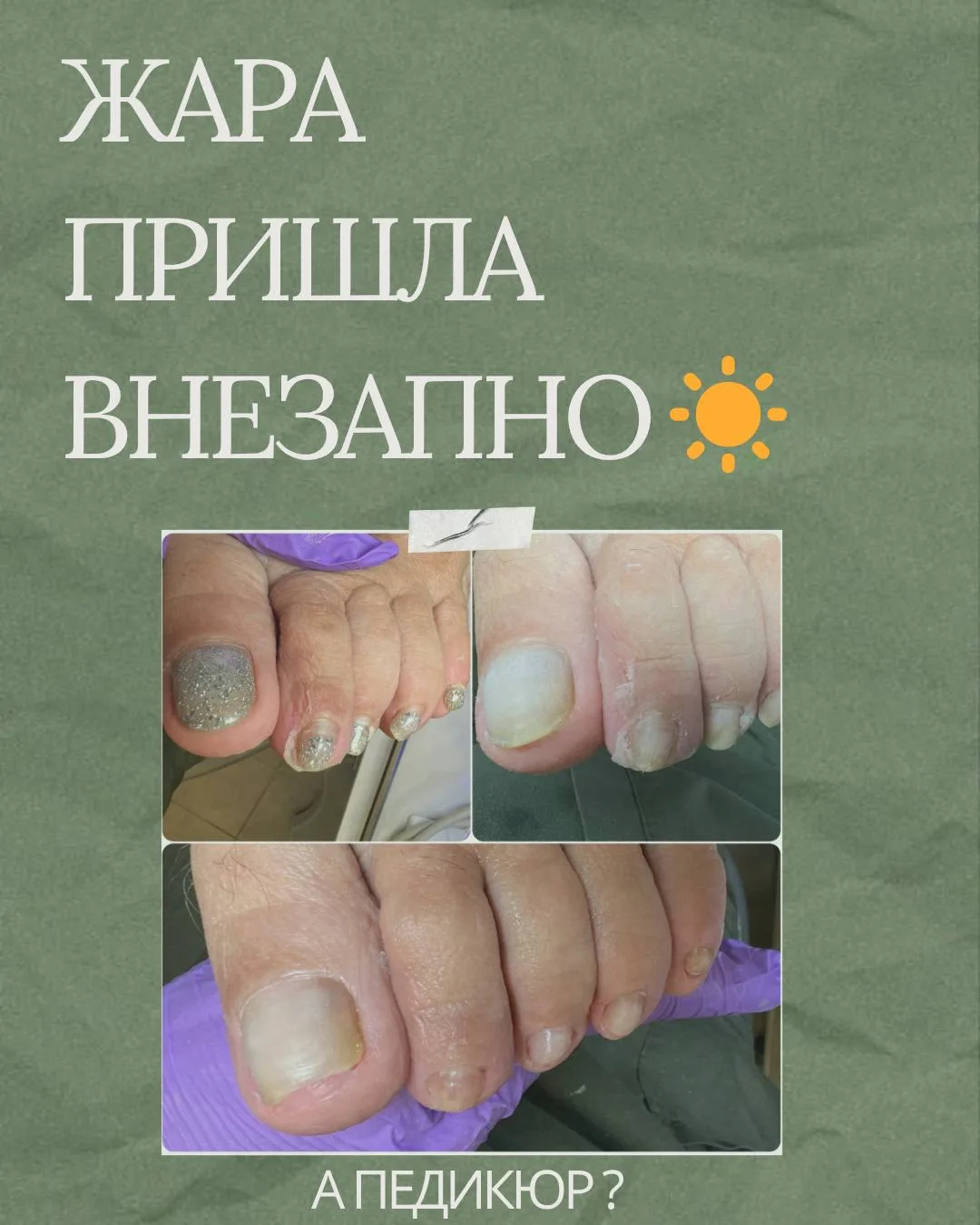 Уже такая жара… а педикюр всё ещё «потом»? 

Самое время это исправить. 

Лето приходит быстро: откр