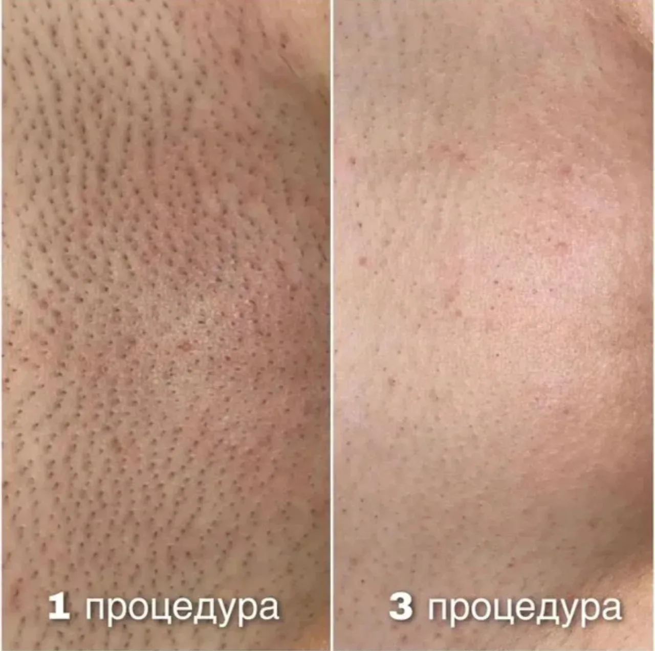 Всем хорошего настроения ❤️‍🩹