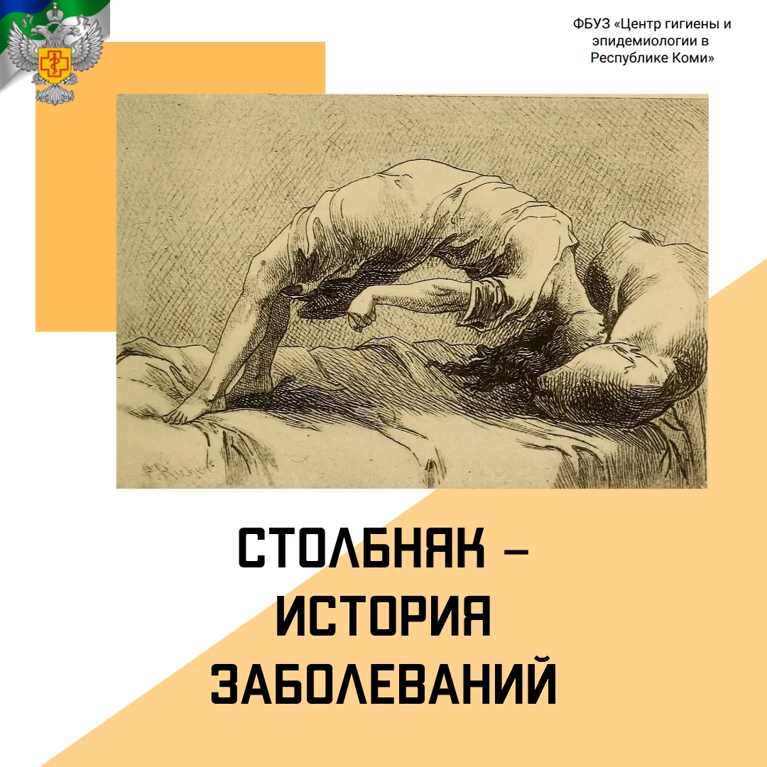 Столбняк: история заболевания