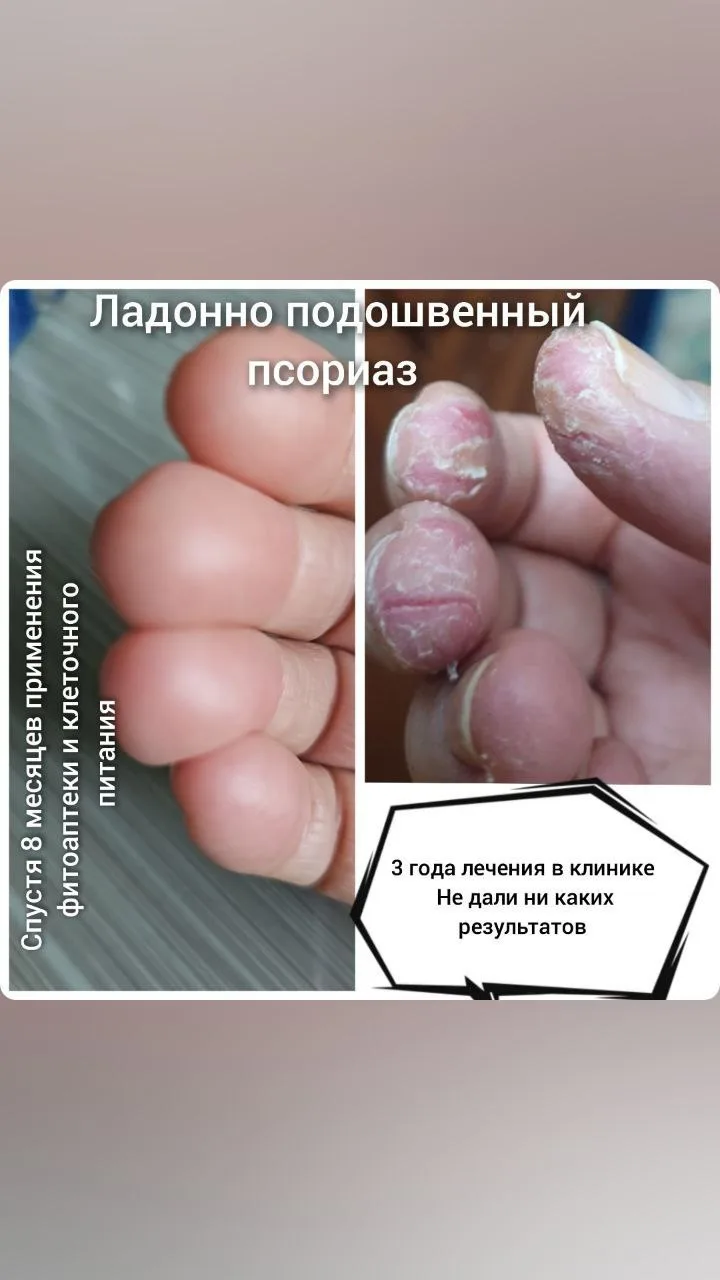 Меня зоаут Раиса ! Мне 63 года .