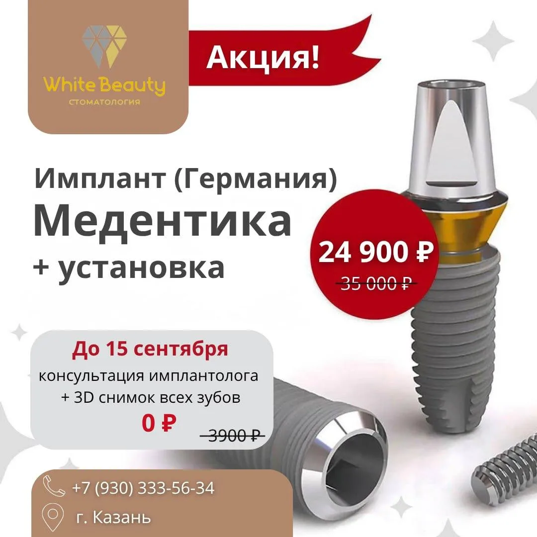 🦷 Потеряли зуб? Не откладывайте имплантацию