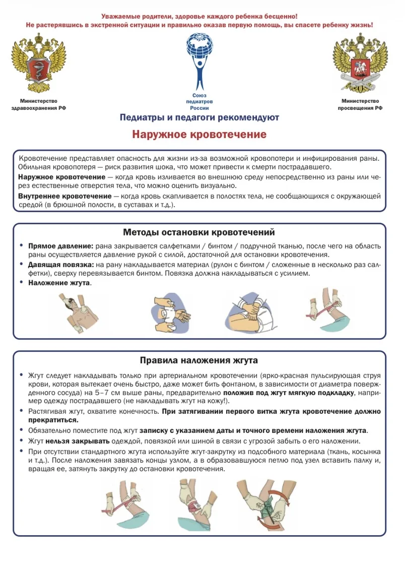 Что делать при наружном кровотечении у ребенка❓