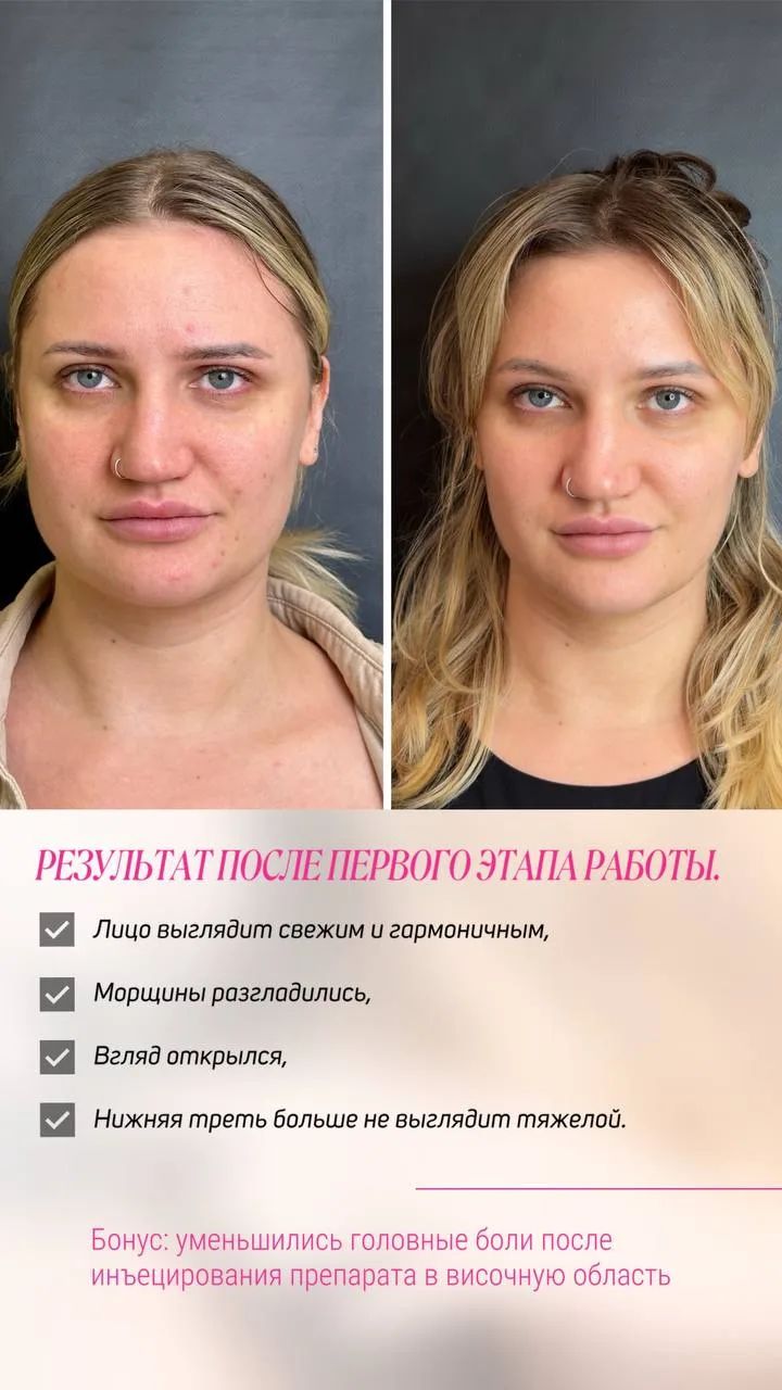 🌟 Выполнено: 150 ед релатокса