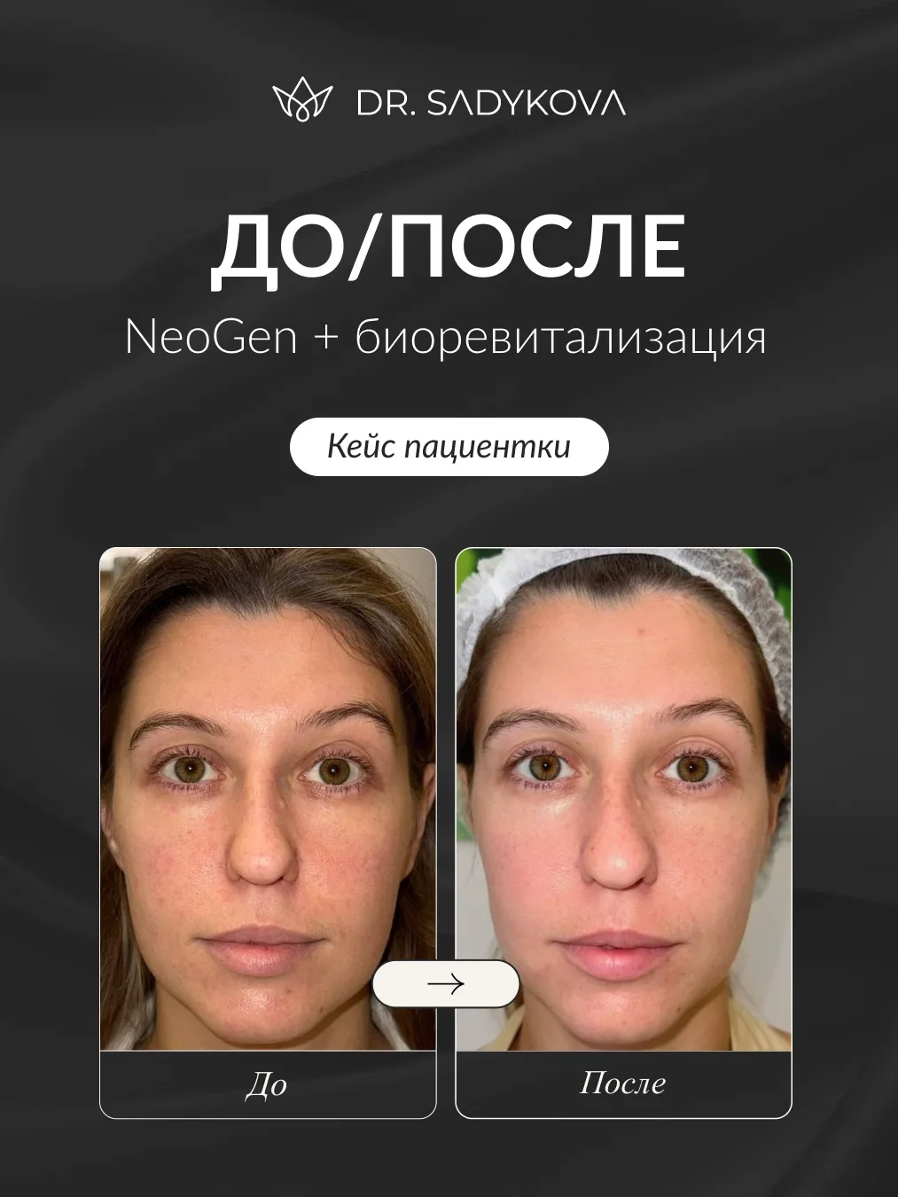 NeoGen всегда круче работает в паре с увлажнением 🤍