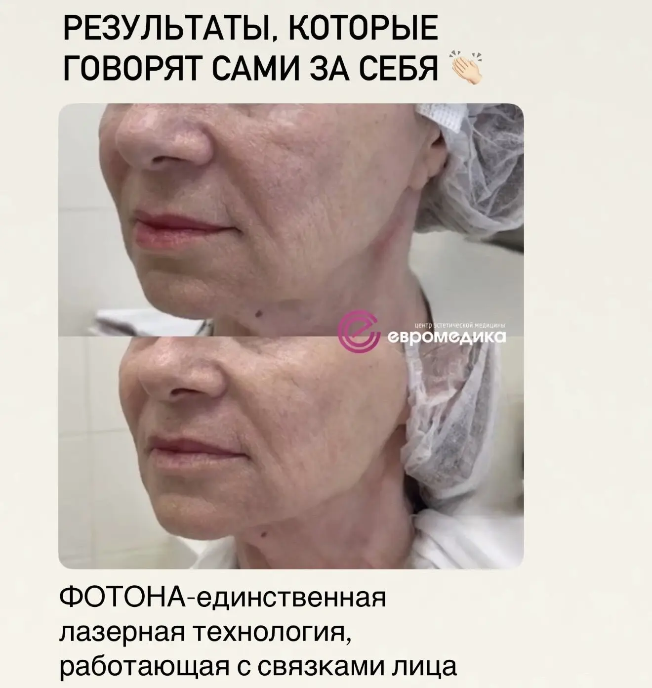 ЧТО БУДЕТ С КОЖЕЙ СРАЗУ