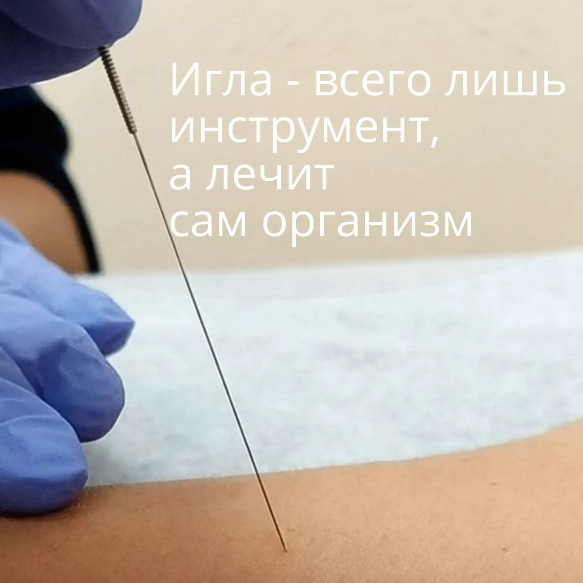 При воздействии игл на биологически активную точку, происходит каскад реакций:
