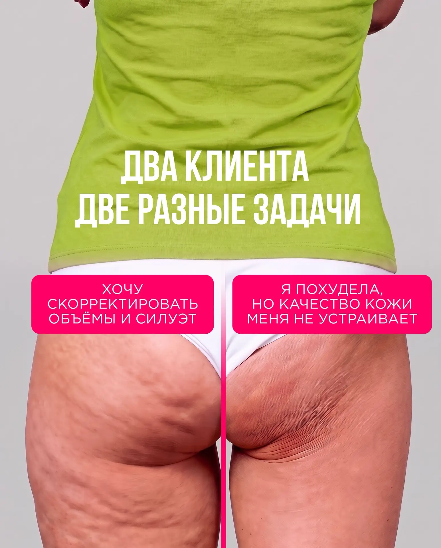 Два типа антицеллюлитных клиентов!