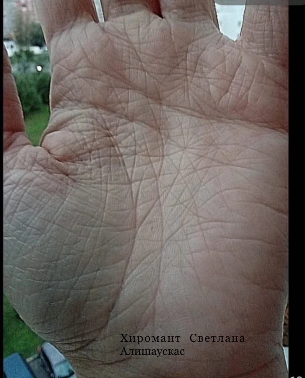 💫Звезда на линии головы.