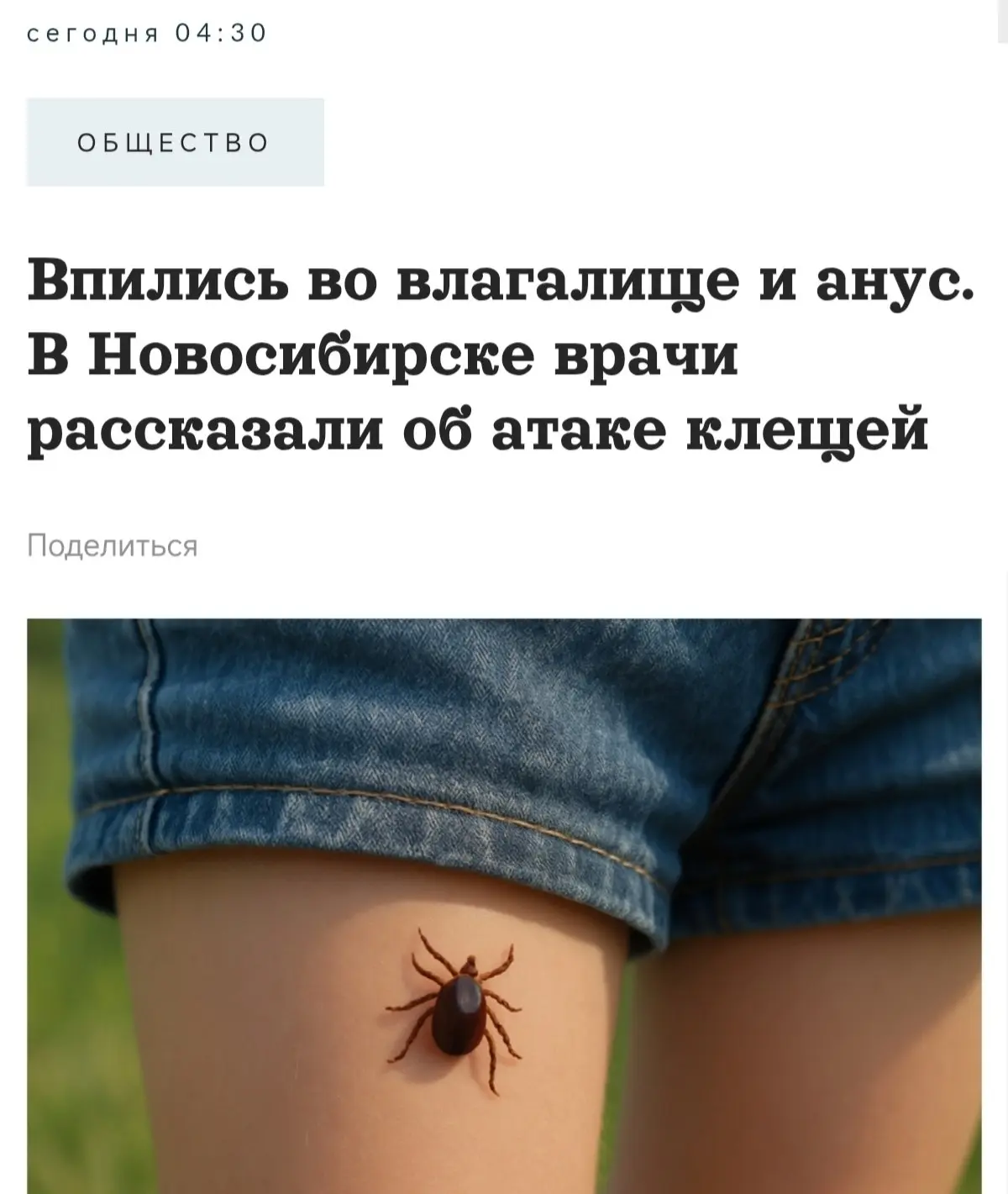 Клещ неделю жил в заднице у новосибирца.